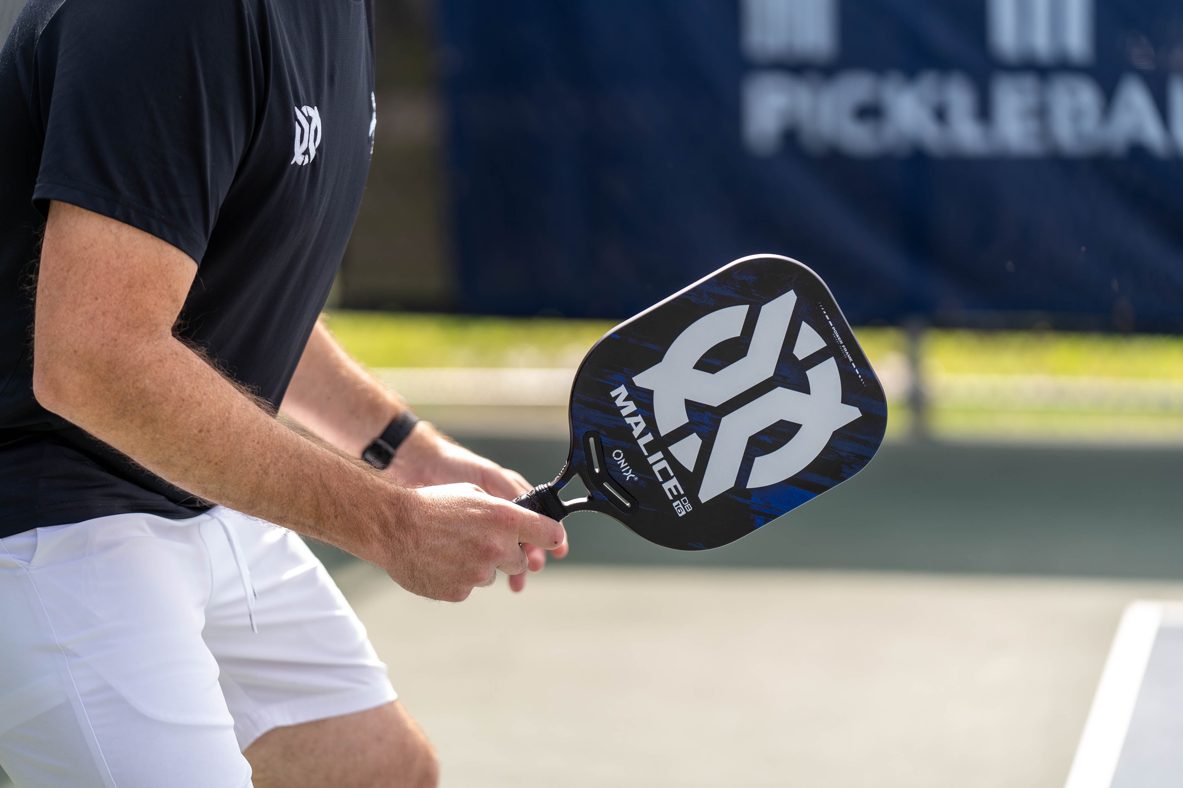 onix-pickleball-malice-db-open-throat-composite-pickleball-paddle image 3